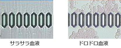 院長コラム：血液さらさらを考える(1)