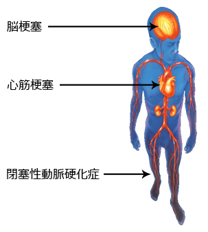 血液さらさらを考える