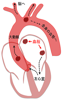 血液さらさらを考える