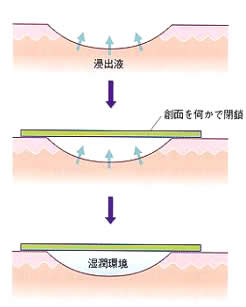 キズの治し方