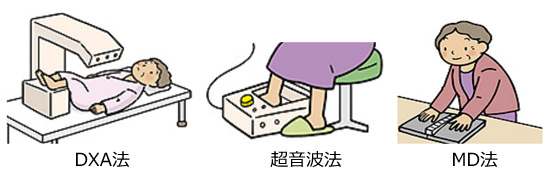 院長コラム:骨粗鬆症について(2)