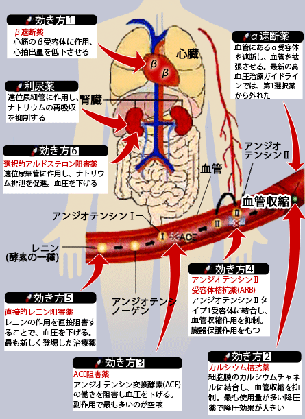 高血圧について