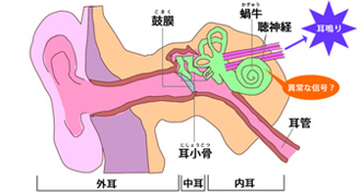 耳鳴り(2)