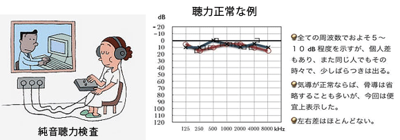 院長コラム：耳鳴り(3)