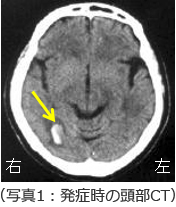 耳鳴り(4)