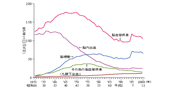 脳出血について