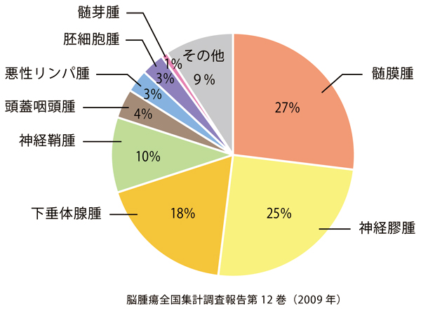 院長コラム：脳腫瘍(1)