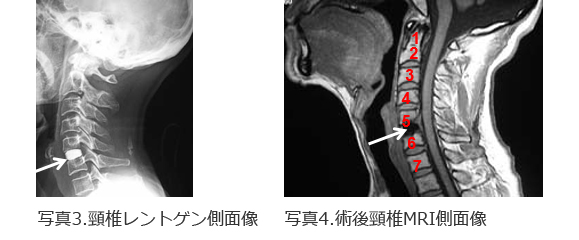 院長コラム：しびれ(3)