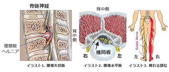 院長コラム：しびれ(4)