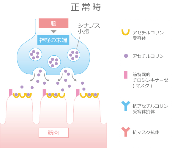 院長コラム：神経難病(3)