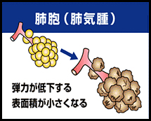 タバコをやめよう