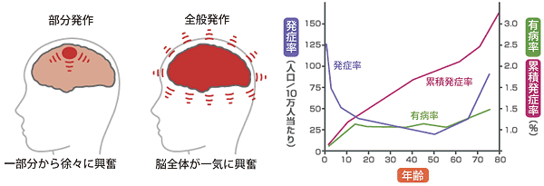 院長コラム：てんかんについて(5)