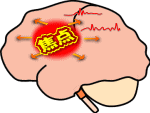 院長コラム：てんかんについて
