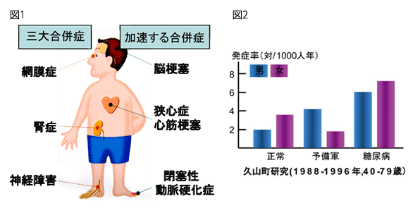 糖尿病について