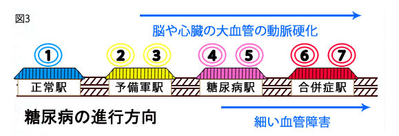 糖尿病について