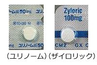 高尿酸血症(痛風)について