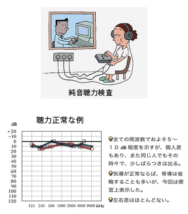 耳鳴り(3)